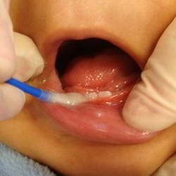 Oral hygiene in babies