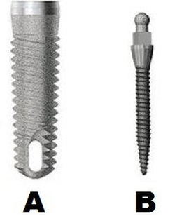 Classic implant vs mini dental implant